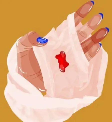 白带有血丝是怎么回事啊