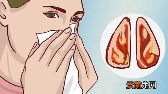 过敏性鼻炎怎么治能除根