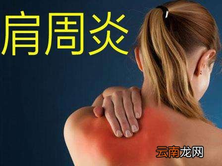 肩周炎怎么治疗最快最好方法
