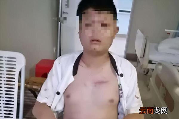 小伙买到发霉食物去理论,竟被打断12根骨头,商家为啥要下这么狠的手