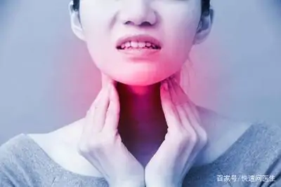 扁桃体发炎该吃什么药物