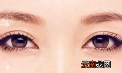双眼皮全切过程