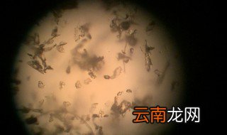 户尘螨是什么东西 户尘螨的含义