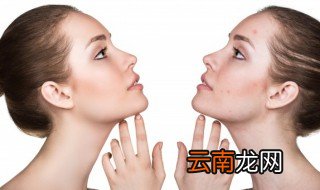 闭口长什么样子 什么是闭口