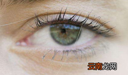 开眼角一般多少钱