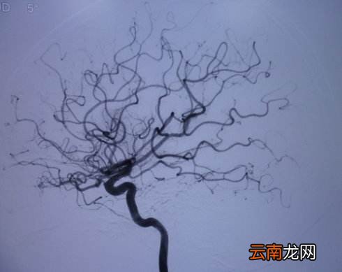造影费用一般多少钱