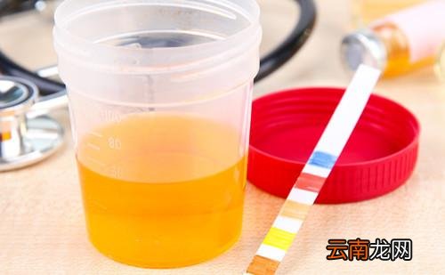 尿检ph值看性别准吗 尿检ph值5.06.07.0生男生女