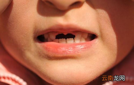 宝宝换牙多久长出新牙 宝宝不长新牙怎么办