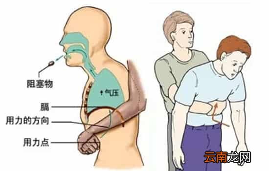 宝宝吞了樱桃核怎么办 通常会自然排出体外