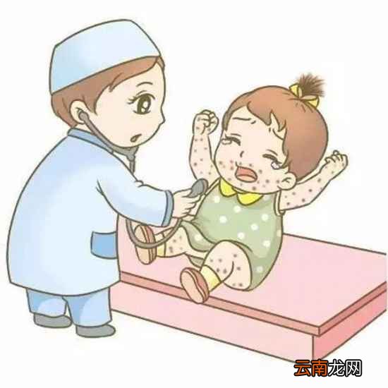 宝宝湿疹的饮食要如何调理 宝宝湿疹妈妈可以吃牛肉吗