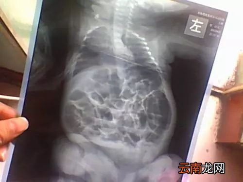 宝宝晚上夜哭的原因 这三个原因最为可能