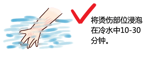 宝宝烫伤后怎么处理 宝宝烫伤问题应急处理