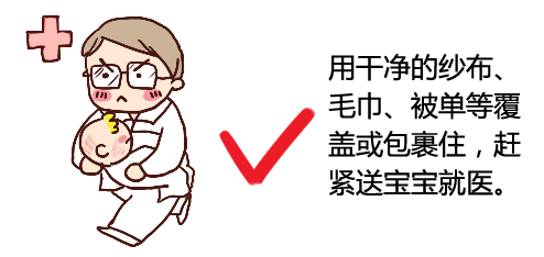 宝宝烫伤后怎么处理 宝宝烫伤问题应急处理