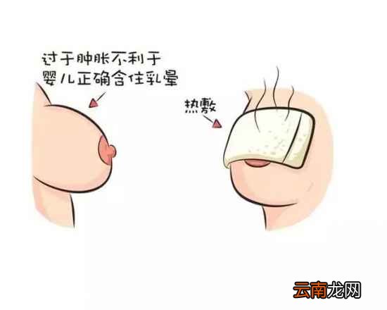 产后胀奶的解决方法 产后胀奶怎么护理好