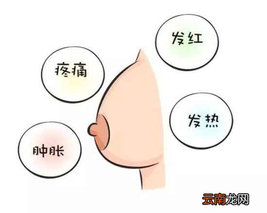 产后胀奶的解决方法 产后胀奶怎么护理好