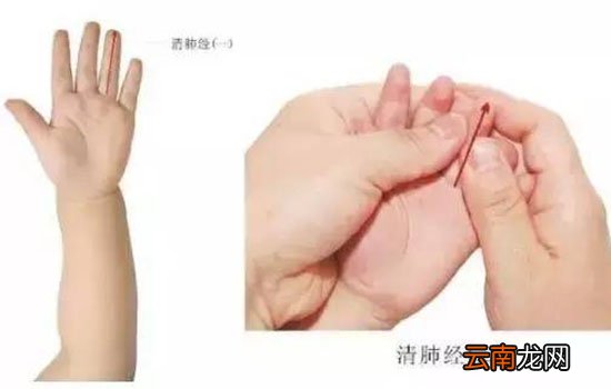 小儿荨麻疹推拿手法图 教你有效缓解荨麻疹