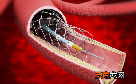 越想睡心跳越厉害睡不着-刚入睡就感觉心脏停跳惊醒是心理问题吗