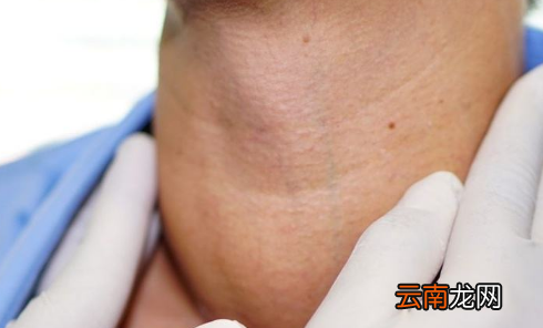 甲亢是整天心率都快吗-甲亢一躺下心脏就咚咚跳怎么办