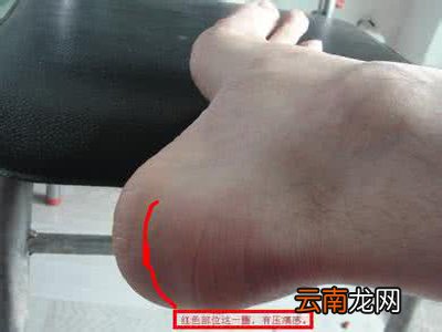 跟腱炎会引起脚背酸痛吗