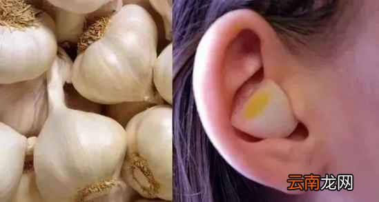 经常吃大蒜有什么好处 它有着这七大药用功效哟