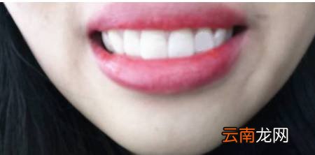 黄牙怎么变白小窍门 教你一分钟让牙齿变白
