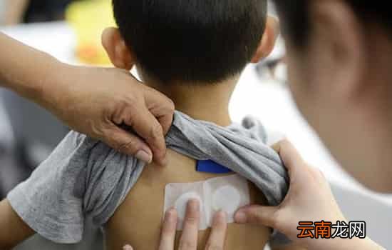 三伏贴可以自己贴吗 并不提倡自己在家贴三伏贴