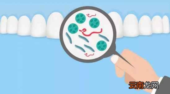 美白牙齿的方法 大美女也抵不住一口黄牙啊