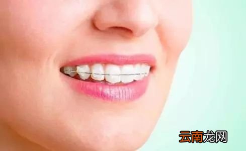 牙缝越来越大怎么回事 缝隙越来越大怎么办