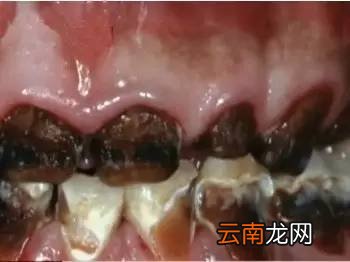 碳酸饮料的危害 你还在让你的孩子和碳酸饮料吗