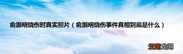 俞灏明烧伤事件真相到底是什么 俞灏明烧伤时真实照片