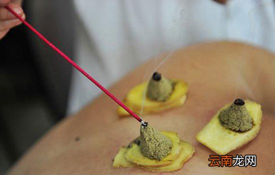 三伏灸一疗程多少钱 三伏灸必须连续艾灸三个疗程吗