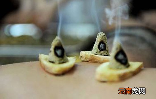 三伏灸一疗程多少钱 三伏灸必须连续艾灸三个疗程吗