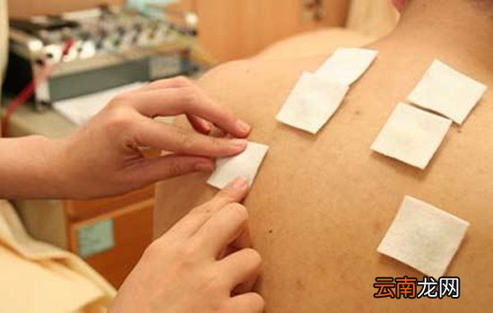 三伏贴可以洗澡吗 贴三伏贴后禁止立即洗澡