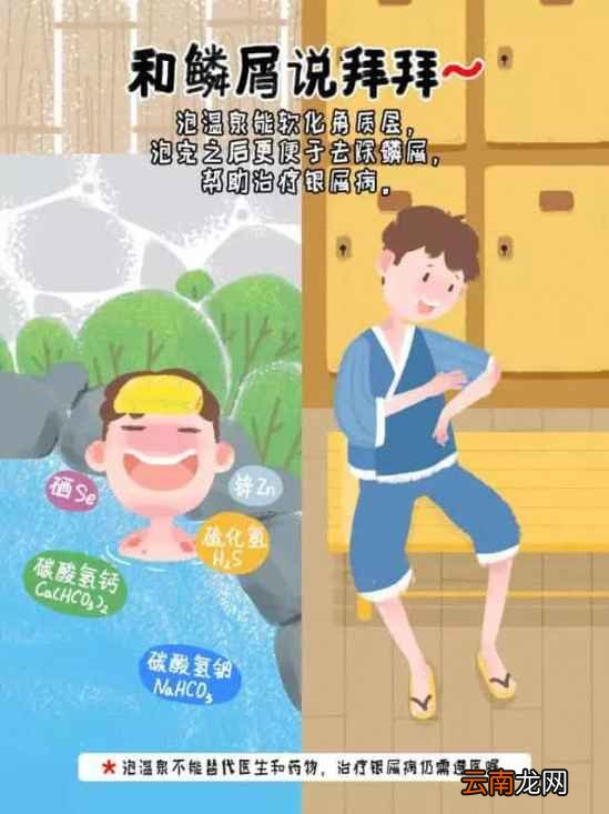 泡温泉治皮肤病吗 牛皮廯能不能泡温泉