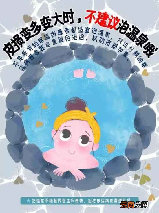 泡温泉治皮肤病吗 牛皮廯能不能泡温泉