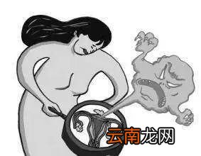卵巢囊肿是什么原因引起的 中医根据年龄保养卵巢