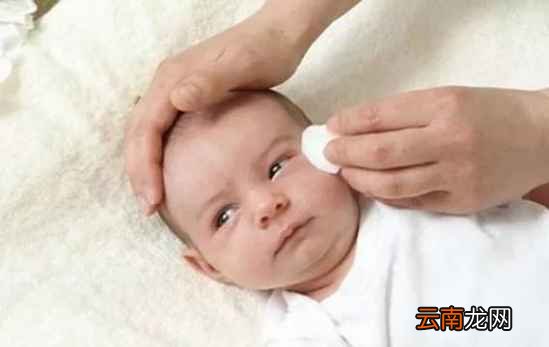 宝宝眼屎多怎么办 宝宝眼屎多应该怎么处理