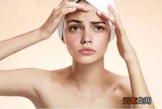 肝脏不好有什么信号 肝脏不好眼睛会出卖你