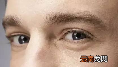肝脏不好有什么信号 肝脏不好眼睛会出卖你