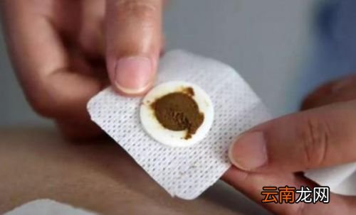 为什么三伏贴要贴3年