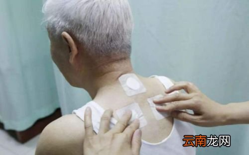 三伏贴到底贴了有效吗