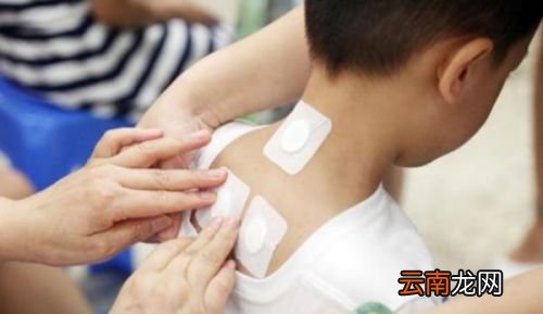 三伏贴的效果有那么神奇吗