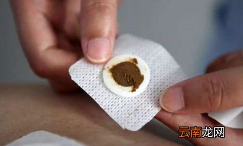 三伏贴的效果有那么神奇吗