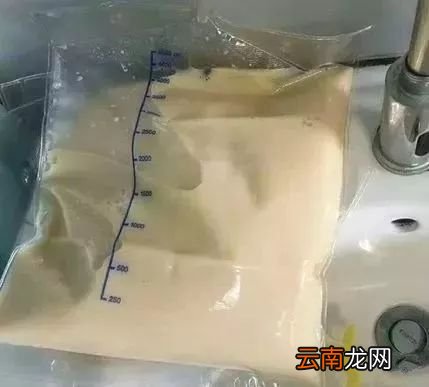 血管硬化的原因 关于血管硬化的几个小问题