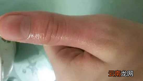 清凉油的功效与作用 有些你绝对不知道