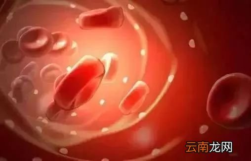 高血脂多吃什么食物好 这15种可多吃