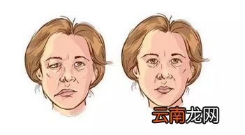 头发没干睡觉的危害 居然会导致面瘫