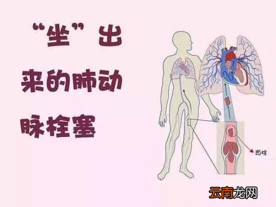 怎样才能变漂亮 这几个坏习惯是你变丑的元凶