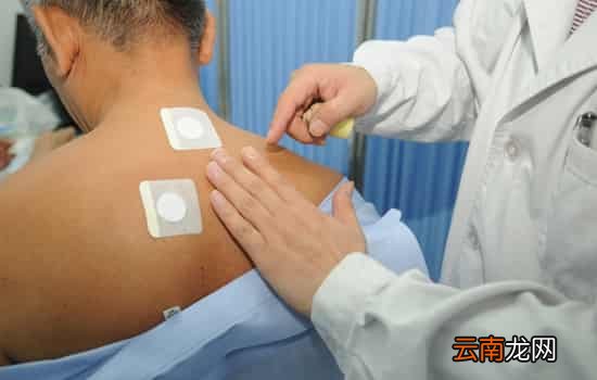 三伏贴可以去湿气吗 三伏贴助风湿排出体内湿气