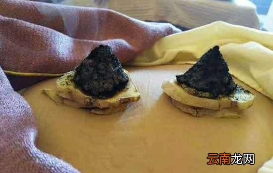 三伏灸宣传语 三伏灸冬病夏治正当时